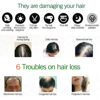 Imbieras Plaukų Augimo Esmė 7 Dienas Germinaciniai Plaukų Augimo Serumas Eterinis Aliejus, Plaukų Slinkimo Gydymas, Greitai Auga Plaukai Vyrai Moterys